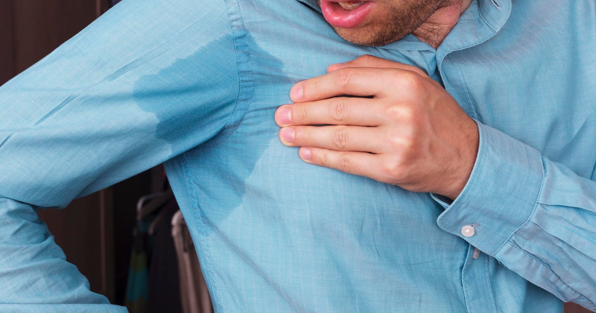 Perspire much? There's help for super-sweaty people - CBS News