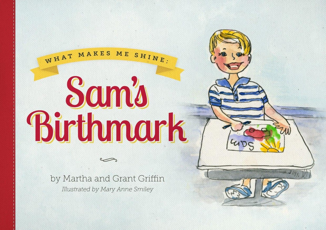 samsbirthmark.jpg 