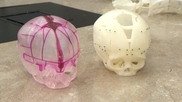 3d-printed-skull-model.jpg 