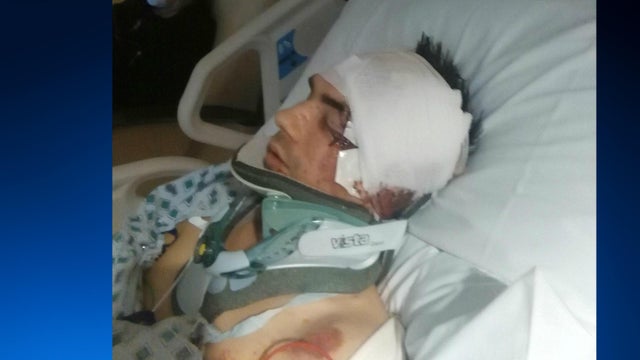 Cameron Asbury is seen in a family photo provided to CBS San Francisco station KPIX-TV after a car thief ran over him in Oroville, California. 