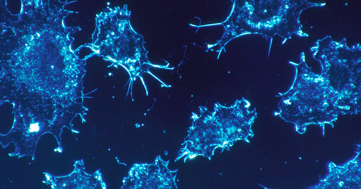 Scientists identify ‘switch’ that can bring about the loss of life of a cancer mobile