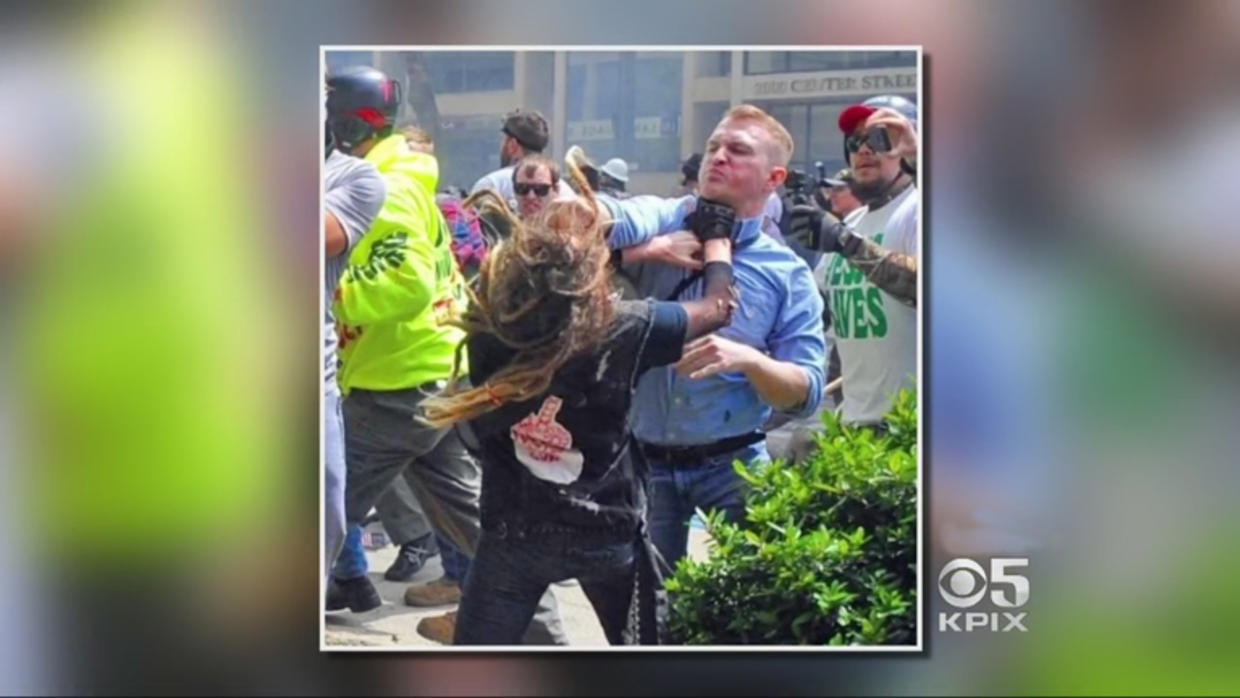 Woman Punched During Berkeley Protest Describes Melee Cbs San Francisco 0563