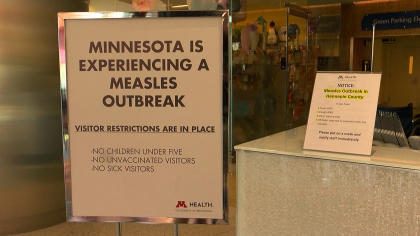 minnesota-measles-outbreak-2017-5-5.jpg 