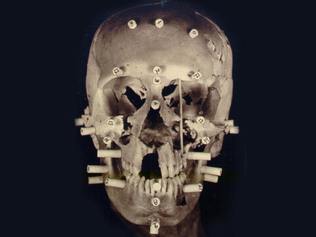 Annie Tahan skull reconstruction 
