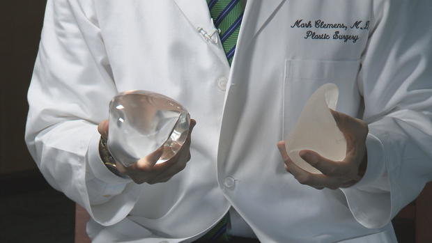 dr-clemens-implants-in-hand.jpg 