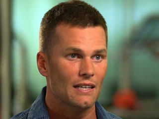 Is Tom Brady Losing His Hair? - CBS News