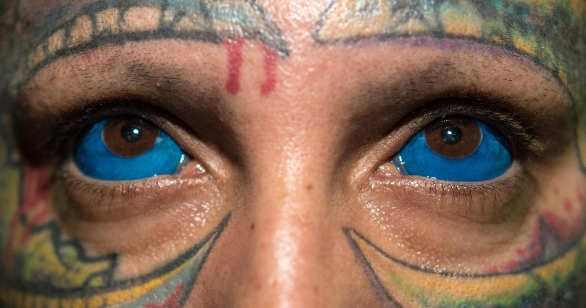 Polish model ends up blind in one eye after botched eyeball tattoo procedure