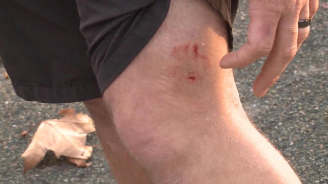 0101-dotcom-dogattack-1472958-640x360.jpg 