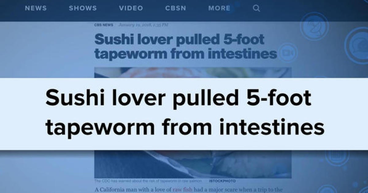 Man Got 5-foot Tapeworm From Eating Sushi - CBS News