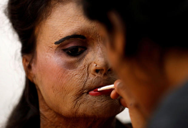 An acid attack survivor has her makeup done backstage prior to a fashion show to mark International Women's Day in Thane on the outskirts of Mumbai 