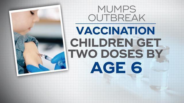 0321-en-lapook-mumps1-1527724-640x360.jpg 