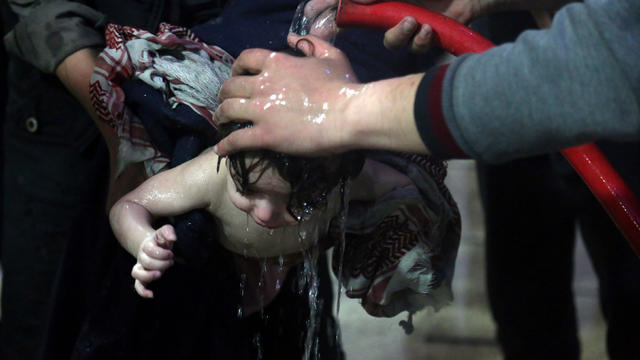 A child is treated in a hospital in Douma, eastern Ghouta in Syria, after what a Syria medical relief group claims was a suspected chemical attack 