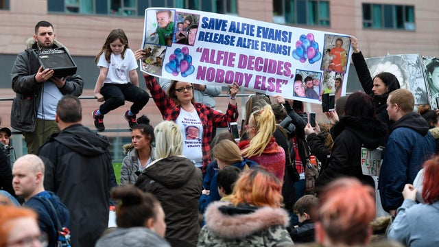 BRITAIN-HEALTH-CHILDREN 