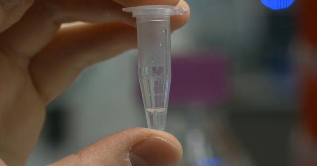 Gene-editing tool CRISPR used inside a human's body for the first time ...