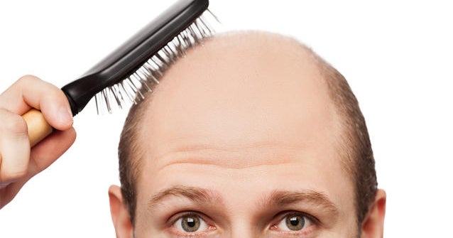 Could this experimental drug treat baldness? - CBS News