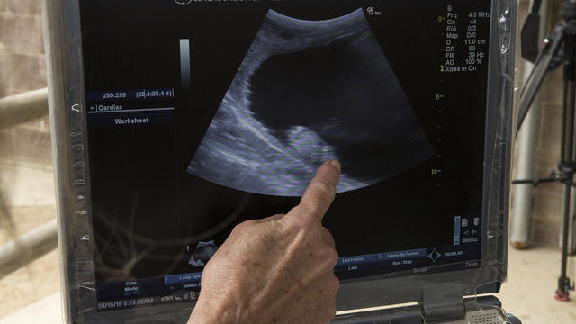 rhino-ultrasound.jpg 