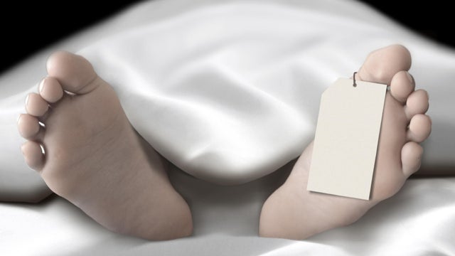 Body lying in the morgue 