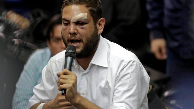 FILE PHOTO: Juan Requesens, deputy of the Venezuelan coalition of opposition parties (MUD), speaks during a session of the National Assembly in Caracas