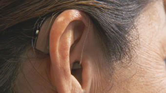 Biotech company aims to treat sudden hearing loss 