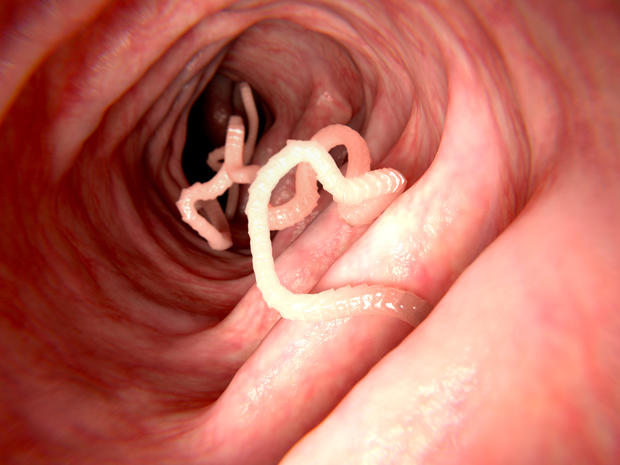 tapeworm-2.jpg 