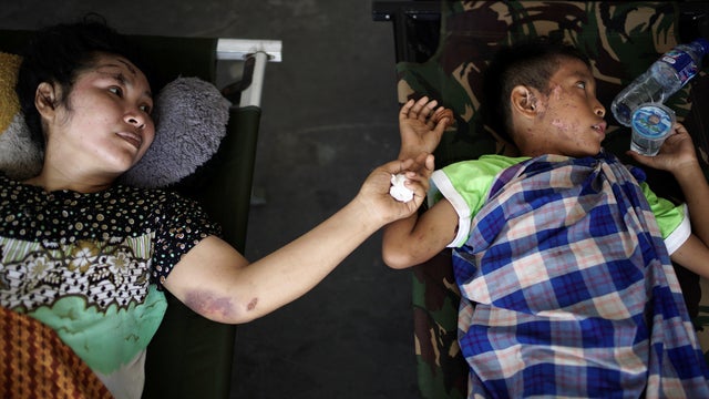 A mother and her son, both injured by the earthquake and tsunami, wait to be airlifted out by a military plane at Mutiara Sis Al Jufri Airport in Palu, Central Sulawesi 