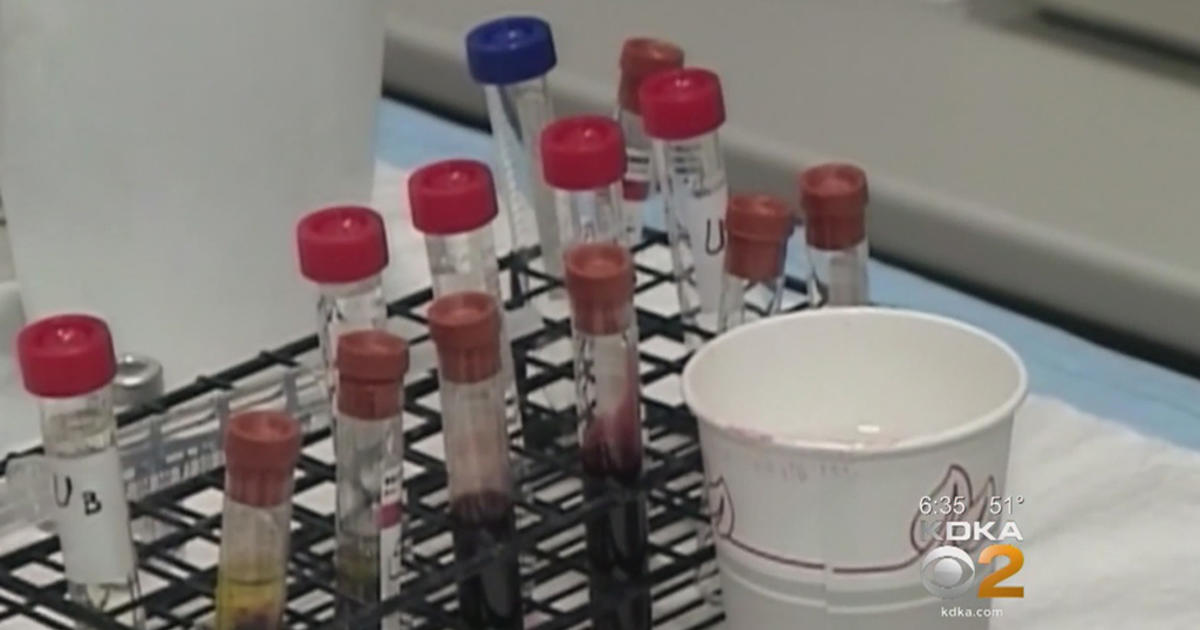 new-type-of-blood-test-could-help-determine-heart-attacks-sooner-cbs