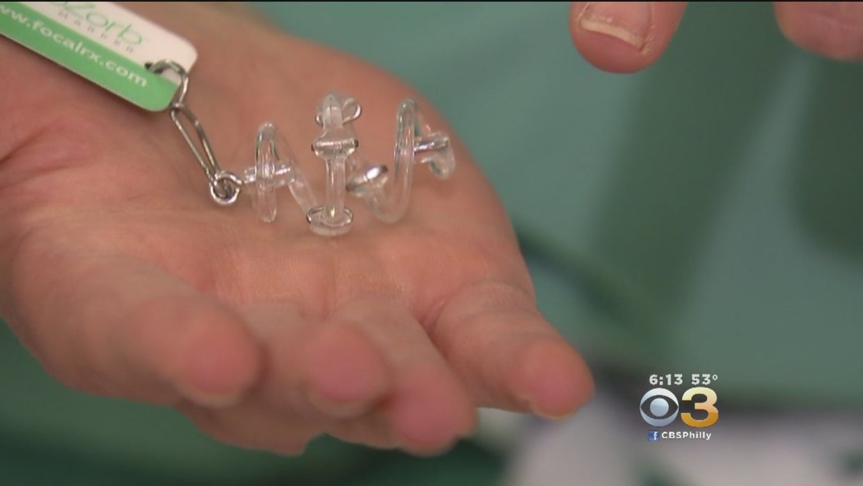 A Small Device With Big Benefits For Breast Cancer Patients - CBS ...