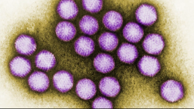 adenovirus outbreak 
