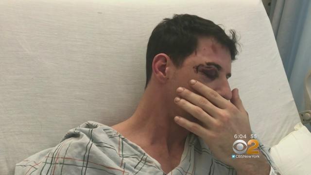 queens-man-attacked-by-correction-officer.jpg 