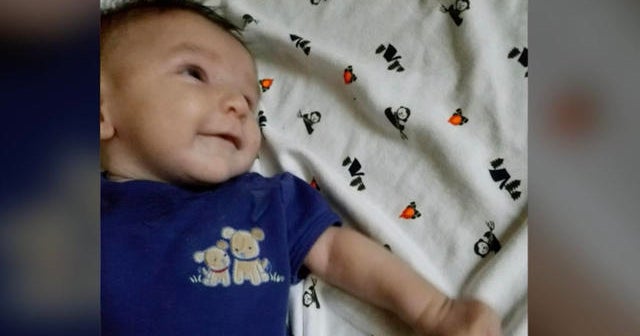 Trial underway for father whose baby "died of diaper rash" CBS News