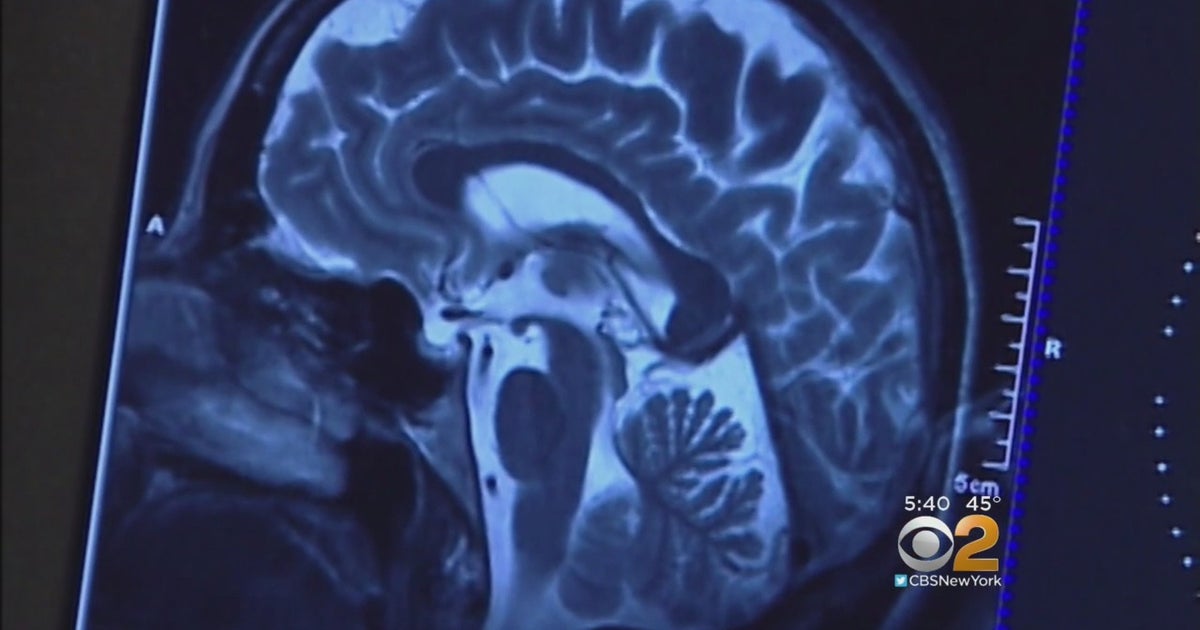 Health Watch: Mobile MRI Lab Offers Free Scans To Battle Brain Cancer ...