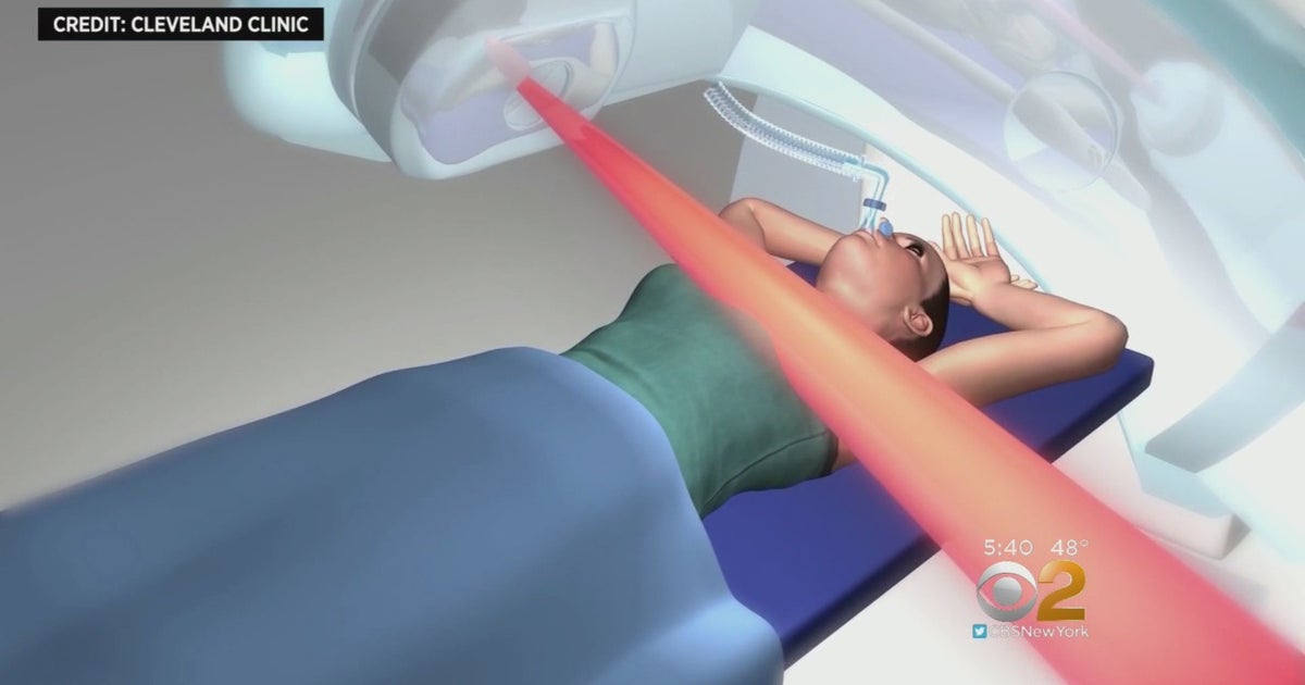 New Technique Helping Women Avoid Heart Problems During Breast Cancer ...
