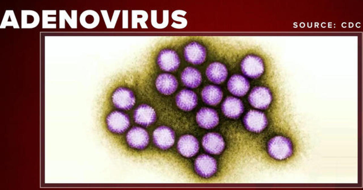 At least 12 dead amid adenovirus outbreak CBS News