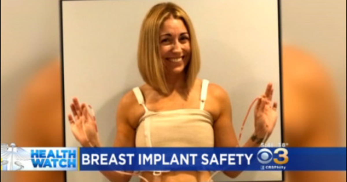 Many Women Getting Breast Implants Removed In Light Of Health Concerns