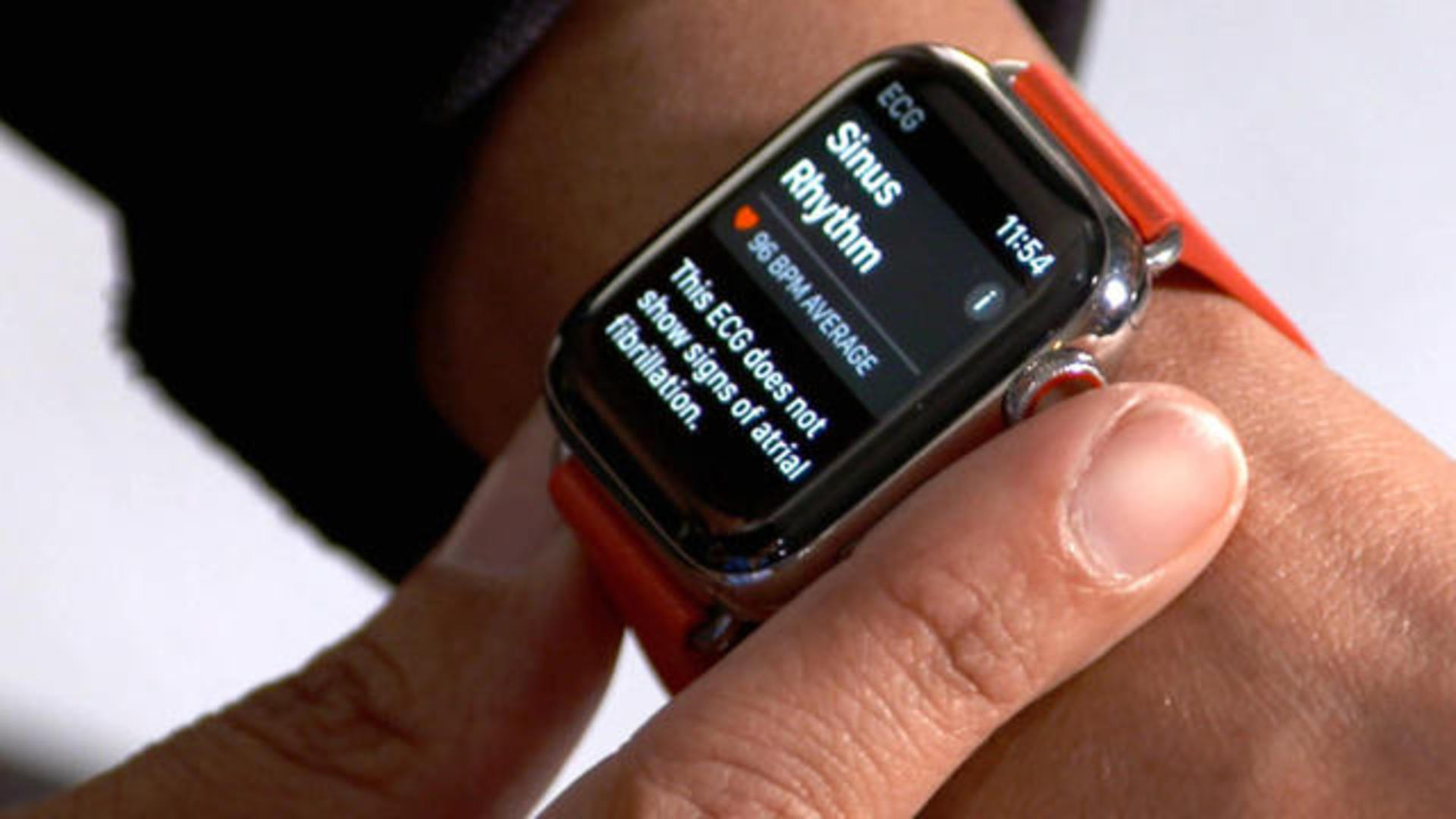 Apple Watch Blood Pressure Monitor Hits Development Snags – channelnews