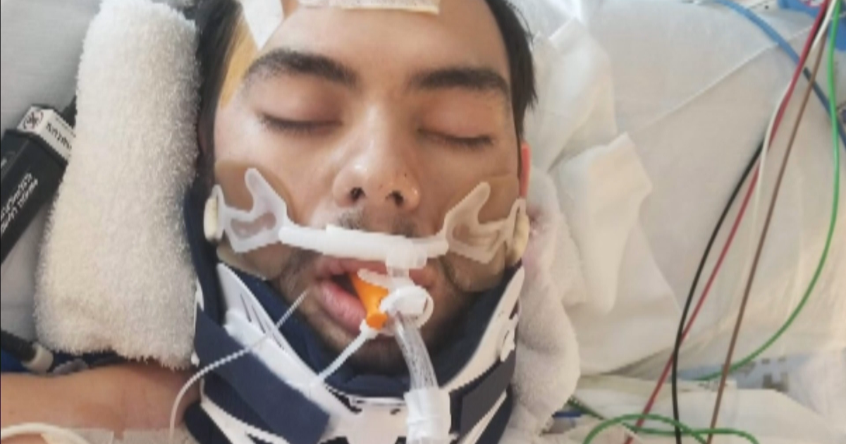 19-Year-Old Motorcyclist Fights For His Life After Being Hit By DUI ...