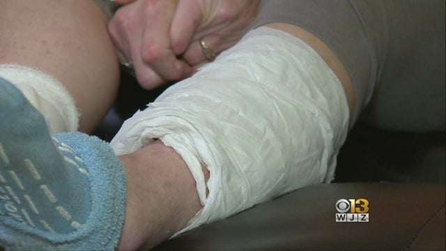 woman-recovering-after-weekend-pit-bull-attack.jpg 