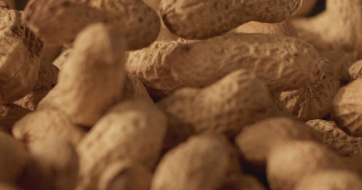 Some 60,000 children have prevented peanut allergy symptoms on account of landmark 2015 recommendation, examine finds