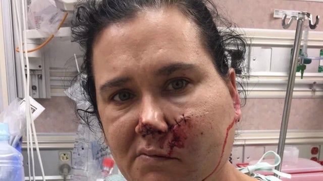 arkansas_woman_shot_in_face_with_crossbow_wreg.com_-_2019-02-14_10.59.17.jpg 