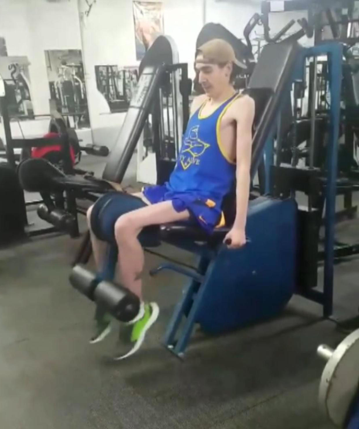 Bodybuilder With Cystic Fibrosis Uses Lifting to Inspire Others CBS