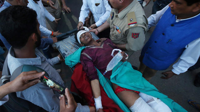 A civilian, who according to local media, was injured in a cross-border shelling near the Line of Control (LoC) with Pakistan in Poonch sector, is rushed to a hospital in Jammu 