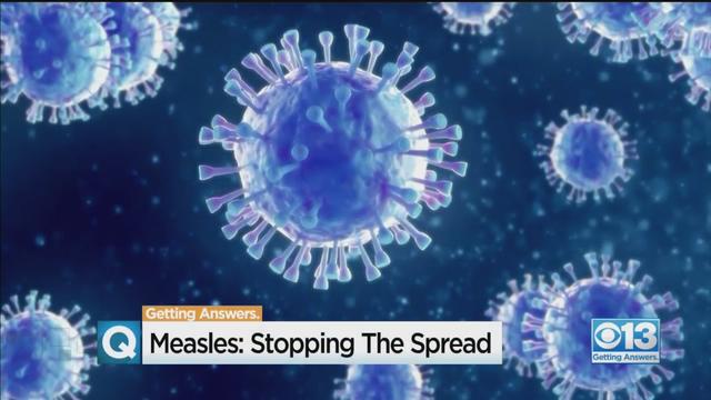 measles-micro.jpg 