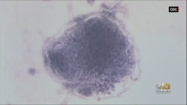 measles-virus.jpg 