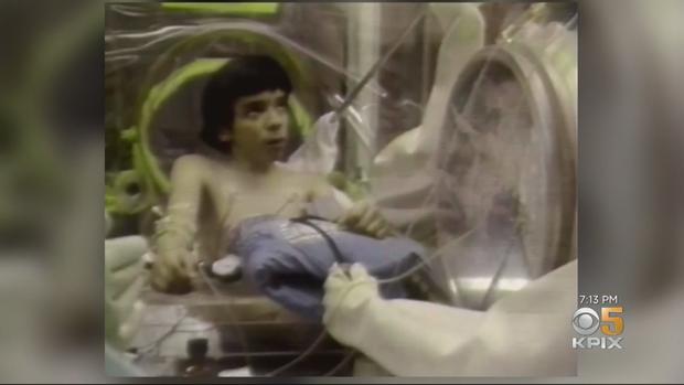 David, the Bubble Boy with SCID (1970's-1980's) 