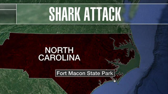 cbsn-fusion-teen-recovers-from-shark-attack-in-north-carolina-thumbnail-1865436-640x360.jpg 