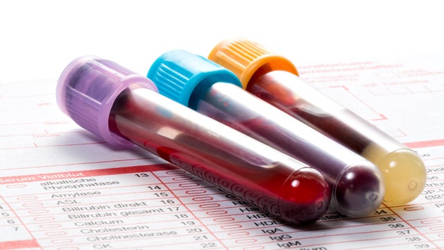 Blood test, blood samples on a laboratory form 