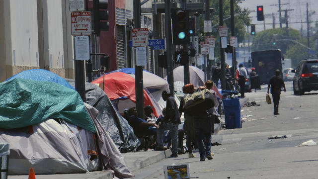 LAPD Typhoid Fever 