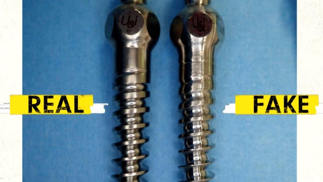 real vs. counterfeit spinal surgery screws 