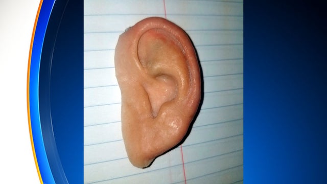 prosthetic-ear-found-on-florida-beach.jpg 
