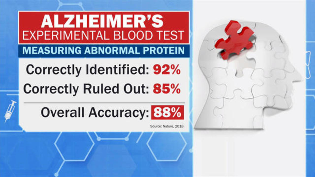 Scientists Close In On Blood Test For Alzheimer's - CBS News